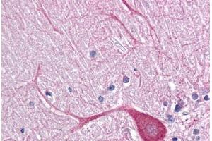 Human Brain, Cerebellum: Formalin-Fixed, Paraffin-Embedded (FFPE) (TLR3 anticorps  (AA 514-657))