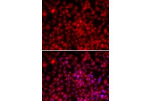 Immunofluorescence (IF) image for anti-Interleukin Enhancer Binding Factor 2, 45kDa (ILF2) antibody (ABIN1980249) (ILF2 anticorps)