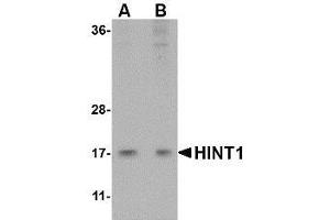 Western blot analysis of HINT1 in Jurkat lysate with AP30394PU-N HINT1 antibody at (A) 1 and (B) 2 μg/ml. (HINT1 anticorps  (Center))