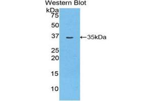 Western Blotting (WB) image for anti-Myosin ID (MYO1D) (AA 512-788) antibody (ABIN1859951) (Myosin ID anticorps  (AA 512-788))
