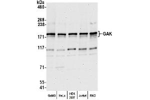 Western Blotting (WB) image for anti-Cyclin G Associated Kinase (GAK) (AA 675-725) antibody (ABIN7453089) (GAK anticorps  (AA 675-725))