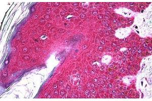 Human Skin: Formalin-Fixed, Paraffin-Embedded (FFPE)