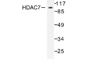 Image no. 1 for anti-Histone Deacetylase 7 (HDAC7) antibody (ABIN265459) (HDAC7 anticorps)