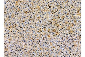 ABIN7095387 and ABIN7099444 at 1/100 staining mouse liver tissue by IHC-P. (Lunapark anticorps)