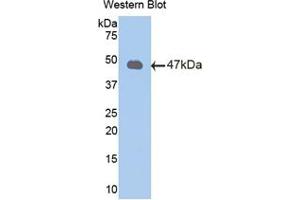 Western blot analysis of the recombinant protein. (Peroxiredoxin 2 anticorps  (AA 6-164))