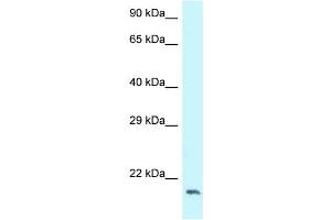 WB Suggested Anti-DCTN3 Antibody Titration: 1. (DCTN3 anticorps  (C-Term))