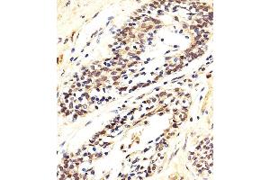 anti-AKT 1/2/3 (AA 278-312) antibody