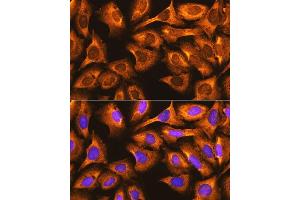 Immunofluorescence analysis of U-2 OS cells using RPS3 antibody (ABIN6128662, ABIN6147219, ABIN6147220 and ABIN6217581) at dilution of 1:100. (RPS3 anticorps  (AA 1-243))