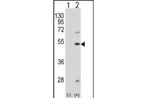 Western blot analysis of FDFT1 (arrow) using rabbit polyclonal FDFT1 Antibody  (ABIN389052 and ABIN2839261). (FDFT1 anticorps  (AA 140-170))