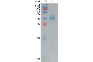 Human A Protein, hFc Tag on SDS-PAGE under reducing condition.