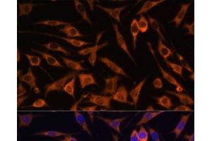 Immunofluorescence analysis of L929 cells using ACAT2 Polyclonal Antibody at dilution of 1:100.