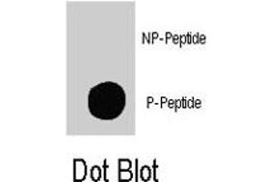 Dot blot analysis of TSC2 (phospho S939) polyclonal antibody  on nitrocellulose membrane. (Tuberin anticorps  (pSer939))