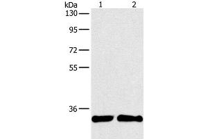 Western Blot analysis of A431 and 231 cell using ARTN Polyclonal Antibody at dilution of 1:350 (ARTN anticorps)