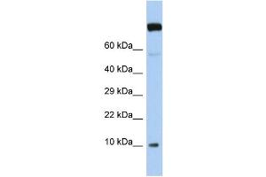 Host:  Rabbit  Target Name:  WBP5  Sample Type:  Jurkat Whole Cell lysates  Antibody Dilution:  1. (WW Domain Binding Protein 5 (WBP5) (N-Term) anticorps)