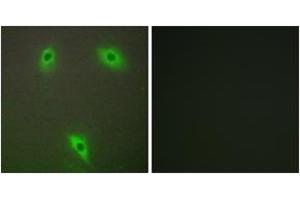 Immunofluorescence analysis of A549 cells, using KLHL3 Antibody. (KLHL3 anticorps  (AA 10-59))