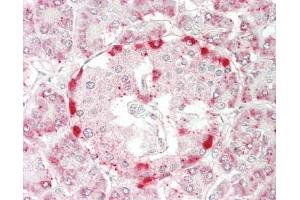 Human Pancreas: Formalin-Fixed, Paraffin-Embedded (FFPE). (RPL14 anticorps  (Biotin))