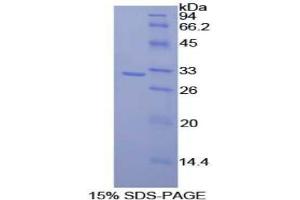 SDS-PAGE analysis of Rat CD2 Associated Protein. (CD2AP Protéine)