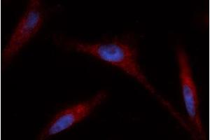 Immunofluorescence (IF) image for anti-Glutaredoxin 1 (GRX1) (AA 1-106) antibody (PE) (ABIN5565554) (Glutaredoxin 1 anticorps  (AA 1-106) (PE))