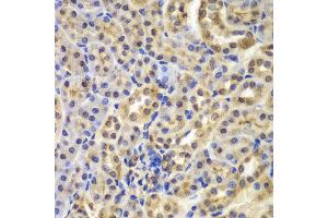 Immunohistochemistry (IHC) image for anti-Nuclear Factor of kappa Light Polypeptide Gene Enhancer in B-Cells Inhibitor, alpha (NFKBIA) (AA 1-317) antibody (ABIN3021668)