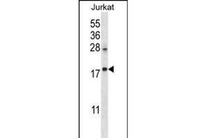 KRT1 Antibody (C-term) (ABIN656288 and ABIN2845597) western blot analysis in Jurkat cell line lysates (35 μg/lane). (KRTAP25-1 anticorps  (C-Term))