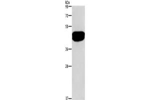Western Blotting (WB) image for anti-serologically Defined Colon Cancer Antigen 3 (SDCCAG3) antibody (ABIN2421479) (SDCCAG3 anticorps)