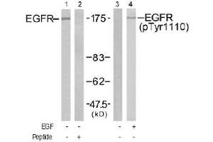 Image no. 2 for anti-Epidermal Growth Factor Receptor (EGFR) (Tyr1110) antibody (ABIN197516) (EGFR anticorps  (Tyr1110))