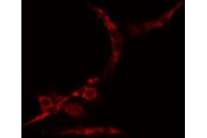 ABIN6274991 staining Hela cells by IF/ICC. (CEP70 anticorps  (Internal Region))