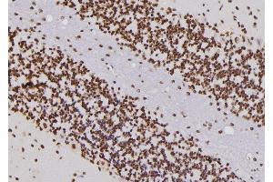 ABIN6276809 at 1/100 staining Rat brain tissue by IHC-P. (CDC25C anticorps  (Internal Region))