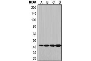 Western blot analysis of HLA-G expression in JEG3 (A), HeLa (B), Raw264. (HLAG anticorps  (Center))