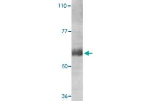 Western blot analysis of IL21R expression in human Raji cell lysate with IL21R polyclonal antibody  at 1 ug /mL . (IL21 Receptor anticorps  (AA 20-32))