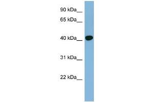 WB Suggested Anti-RING1 Antibody Titration: 0. (RING1 anticorps  (Middle Region))