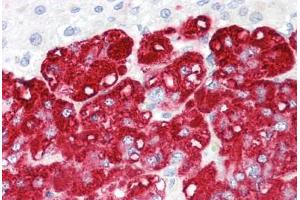 Image no. 2 for anti-Ring Finger Protein 139 (RNF139) (AA 72-121) antibody (ABIN6749727)