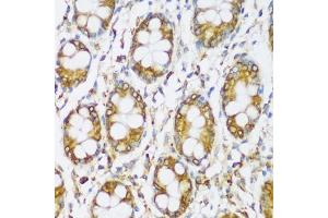Immunohistochemistry of paraffin-embedded human colon using ERLIN1 antibody (ABIN7267005) at dilution of 1:100 (40x lens). (ERLIN1 anticorps  (AA 259-348))