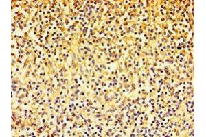 Immunohistochemistry of paraffin-embedded human spleen tissue using ABIN7143385 at dilution of 1:100