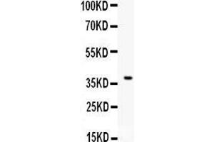 Anti- CD86 Picoband antibody, Western blotting All lanes: Anti CD86  at 0.