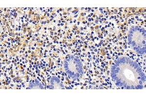 Detection of FAS in Human Appendix Tissue using Polyclonal Antibody to Factor Related Apoptosis (FAS)