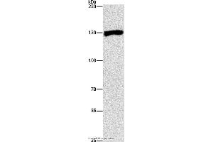 Western blot analysis of Raji cell, using UPF1 Polyclonal Antibody at dilution of 1:300 (RENT1/UPF1 anticorps)