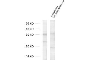 dilution: 1 : 1000, sample: cell lysate from Jurkat cells (PSMD8 anticorps  (AA 4-232))