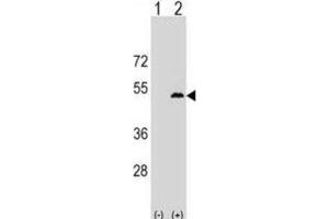 Western Blotting (WB) image for anti-Leupaxin (LPXN) antibody (ABIN2999719) (Leupaxin anticorps)