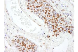 anti-Scaffold Attachment Factor B2 (SAFB2) (AA 175-225) antibody