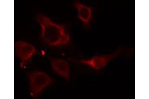 ABIN6274916 staining HepG2 cells by IF/ICC. (SLC27A5 anticorps  (Internal Region))