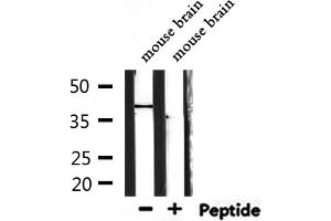 Western blot analysis of extracts from mouse brain, using TAS2R40 Antibody.