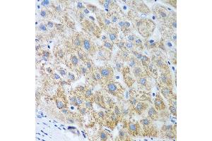 Immunohistochemistry of paraffin-embedded human liver using UBE2U antibody at dilution of 1:100 (40x lens). (UBE2U anticorps)