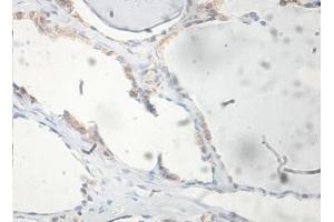 Immunohistochemical staining of formalin-fixed paraffin-embedded human thyroid showing membrane staining with FAM72A antibody at a dilution of 1/100. (FAM72A anticorps  (AA 2-148))
