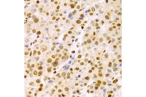 Immunohistochemistry (IHC) image for anti-Dyskeratosis Congenita 1, Dyskerin (DKC1) (AA 245-514) antibody (ABIN1512829) (DKC1 anticorps  (AA 245-514))