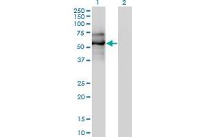 Western Blot analysis of EBF1 expression in transfected 293T cell line by EBF1 monoclonal antibody (M01), clone 1C12. (EBF1 anticorps  (AA 1-591))