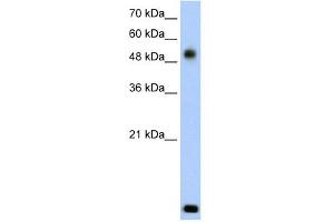RSAD2 antibody used at 2. (RSAD2 anticorps  (N-Term))