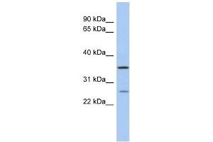 SDR-O antibody used at 1 ug/ml to detect target protein. (SDR9C7 anticorps  (Middle Region))