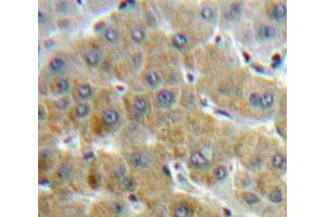 Used in DAB staining on fromalin fixed paraffin-embedded Liver tissue (SAA anticorps  (AA 19-122))