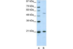 WB Suggested Anti-ZNF31 Antibody Titration:  2. (ZSCAN20 anticorps  (N-Term))